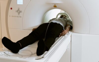 Post-concussion symptoms after a negative CT scan?